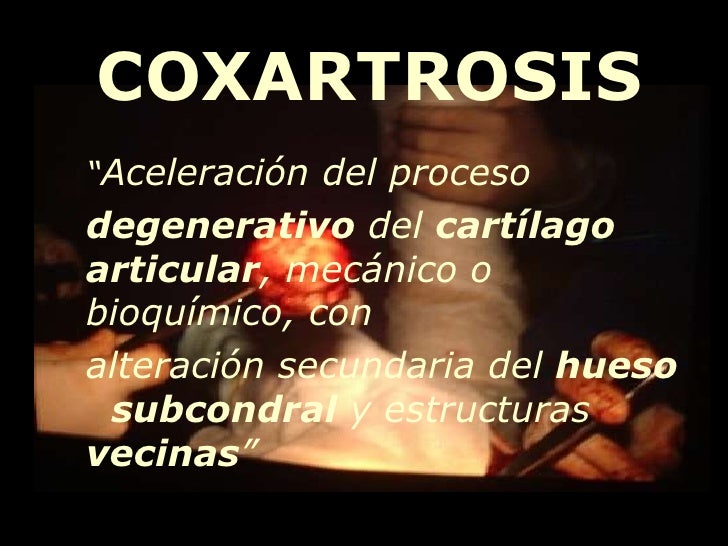 coxartrosis definicion